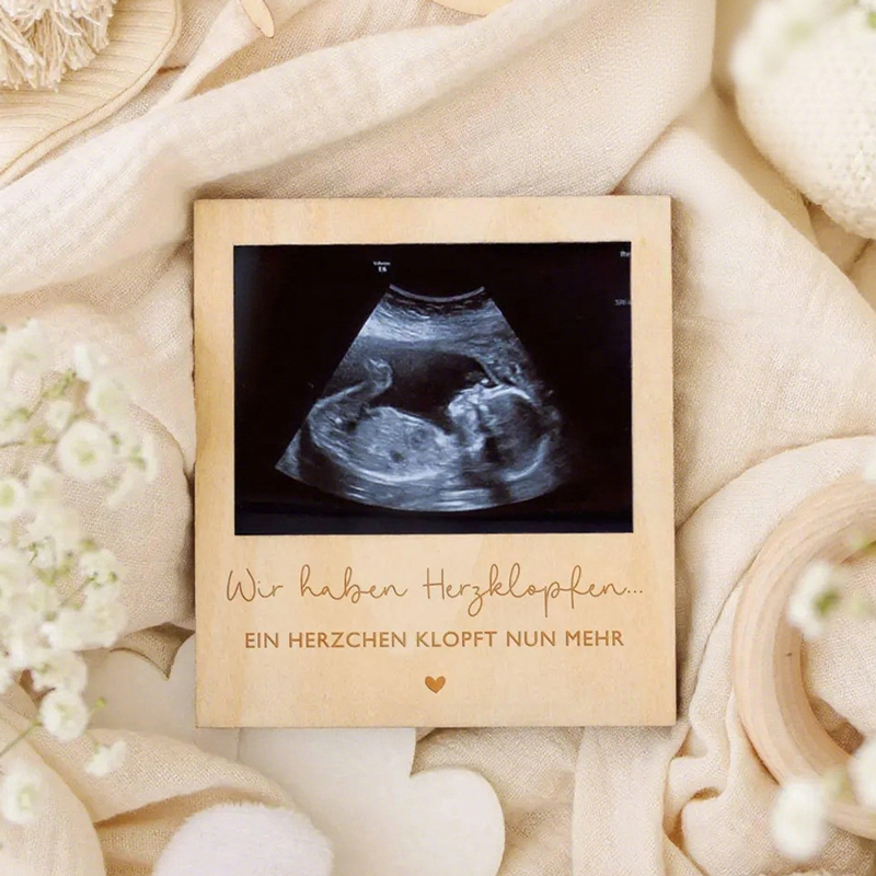 Photo Booth Frame - กรอบรูปไม้สำหรับประกาศตั้งครรภ์ด้วยอัลตราซาวด์ อุปกรณ์ประกอบฉากถ่ายรูปสำหรับงานฉลองครั้งแรกของลูกน้อย ติดผนังหรือวางบนโต๊ะ